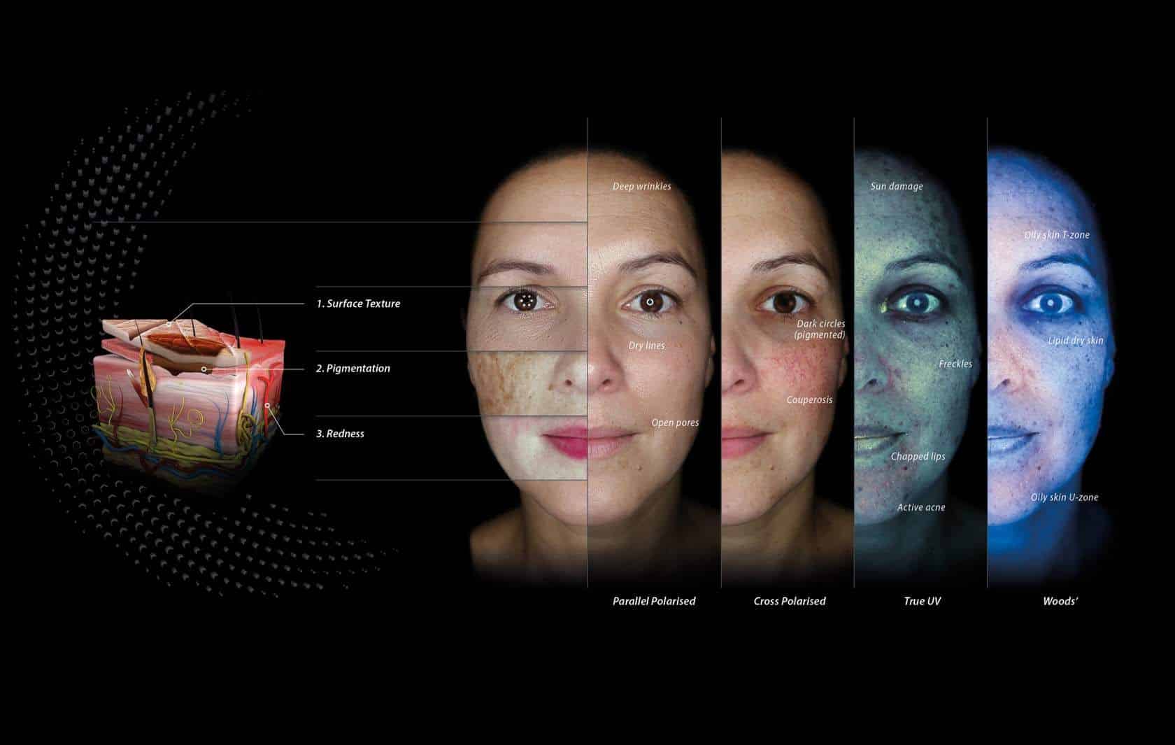 Analysis using the Observ 560 skin analysis technology and diagram showing the layers of the skin