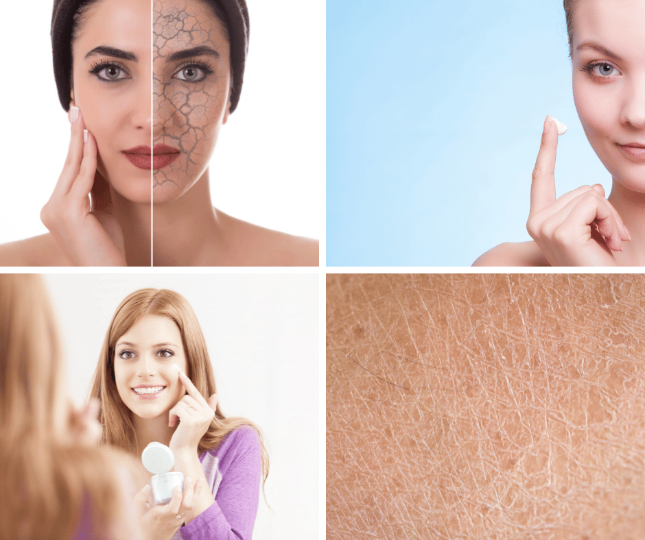 Collage of women with dry skin and applying skincare products