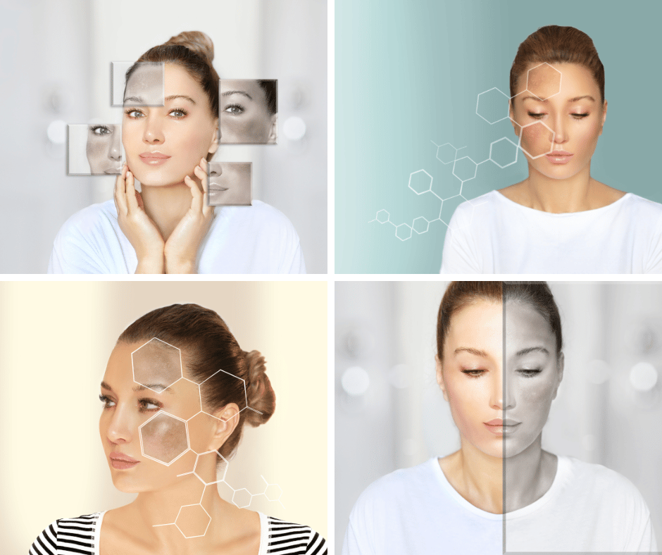 Picture with 4 quadrants showing a woman with different skin conditions